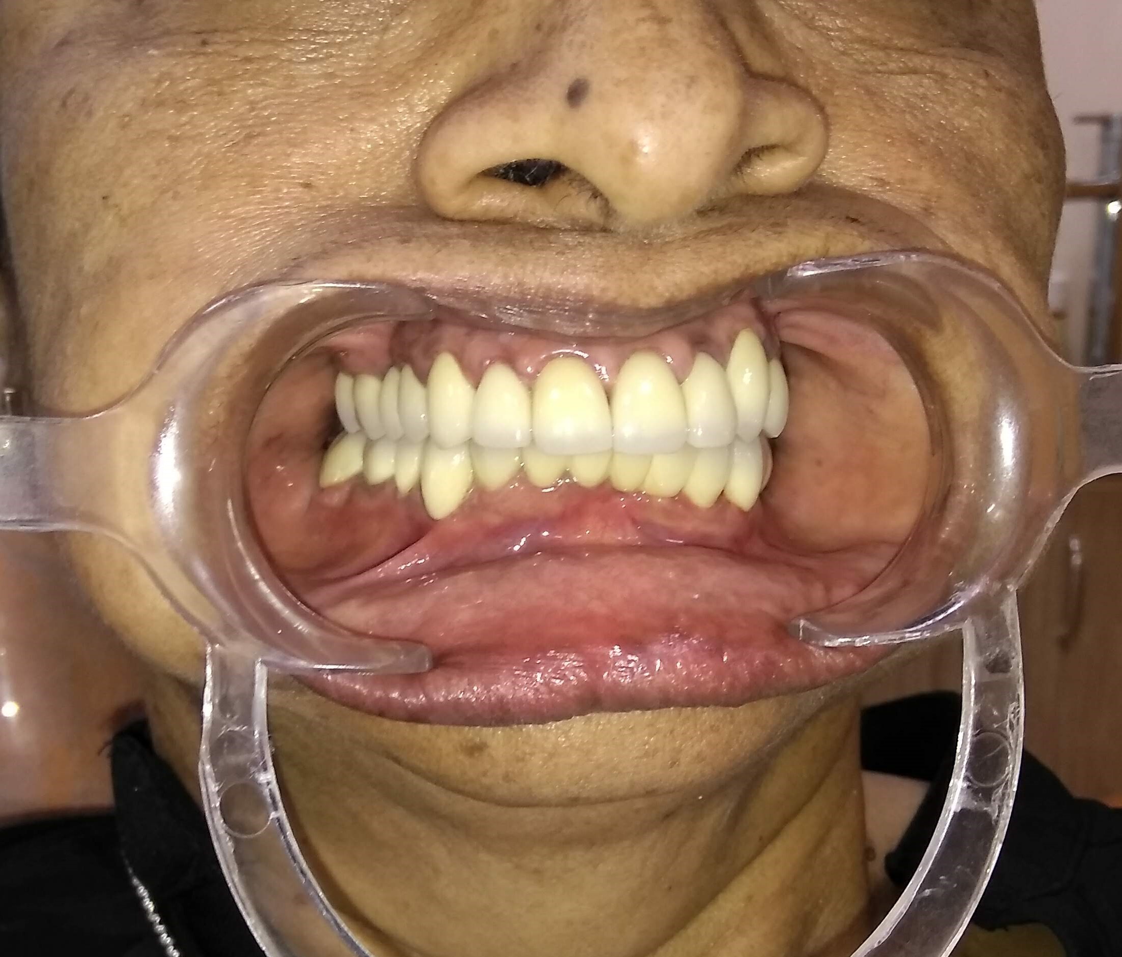 Cosmetic Dentistry